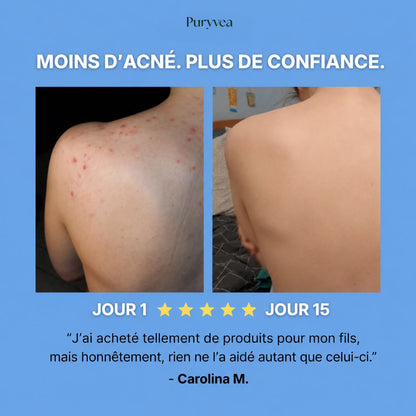 Savon purifiant Anti-Acne™