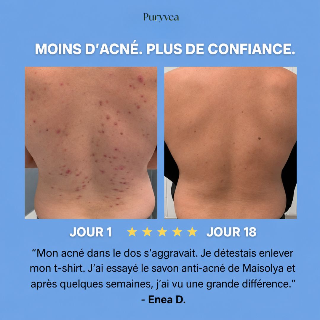 Savon purifiant Anti-Acne™