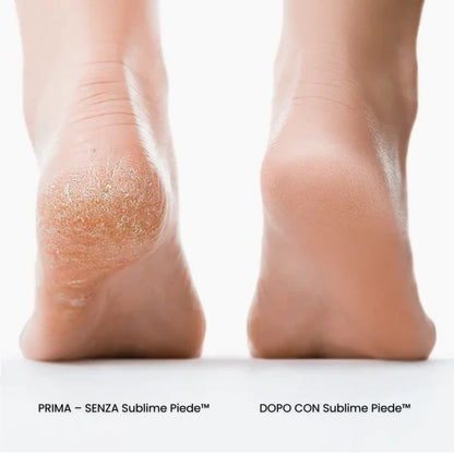 Sublime Piede™ – Piedi perfetti, effetto seta in pochi minuti