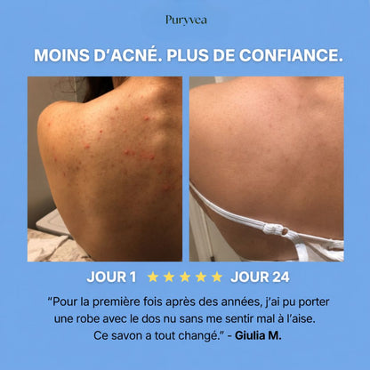 Savon purifiant Anti-Acne™