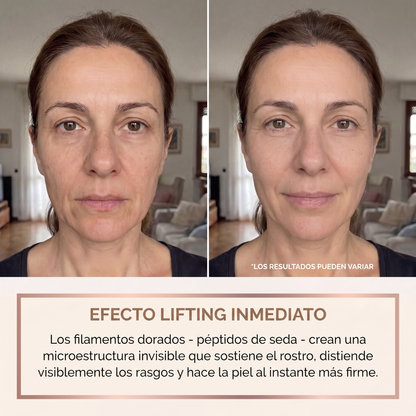 Orvane — Efecto lifting inmediato