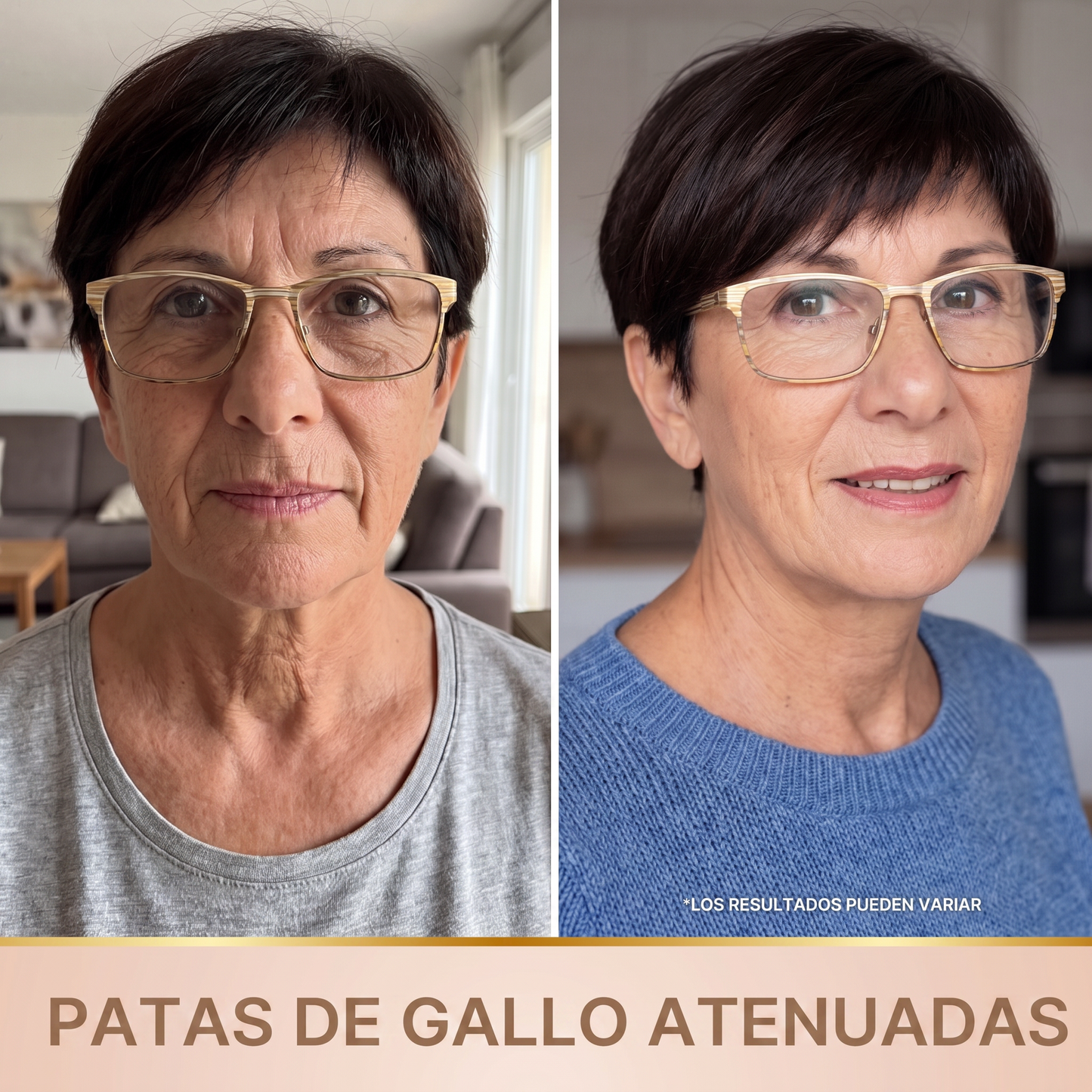 Orvane — Patas de gallo atenuadas
